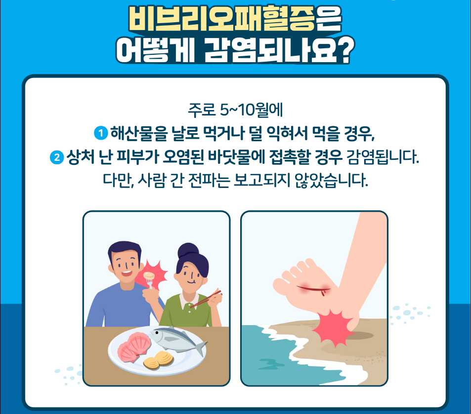 창녕군, 비브리오패혈증 예방수칙 준수 당부